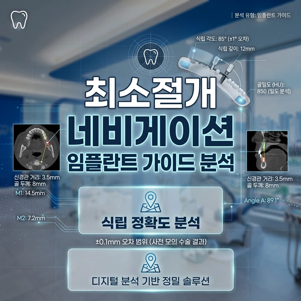 통증 줄인 최소절개 네비게이션 임플란트, 하단임플란트 및 명지임플란트 추천 | 365효플란트치과